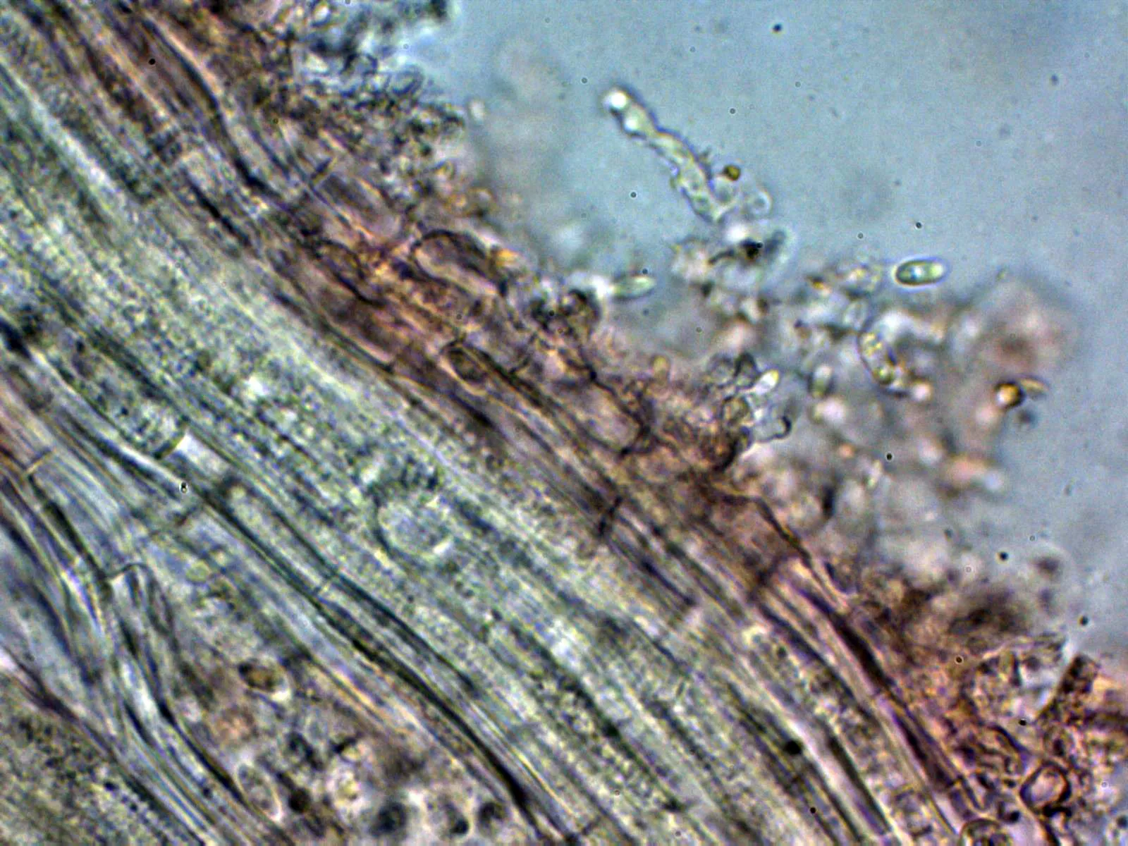Microscopía de Stilbella aleuriata - 11 - Pie 1